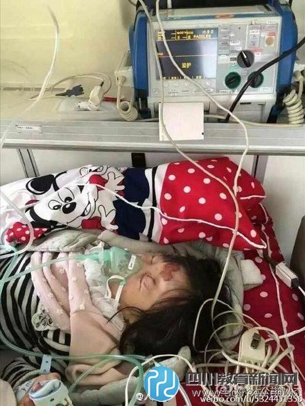 3岁女童遭继母殴打昏迷 警方已介入调查