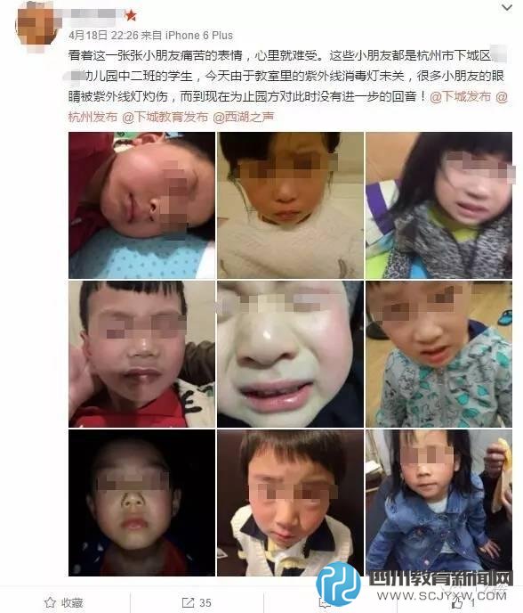 杭州一幼儿园多个孩子眼睛被灼伤:因教