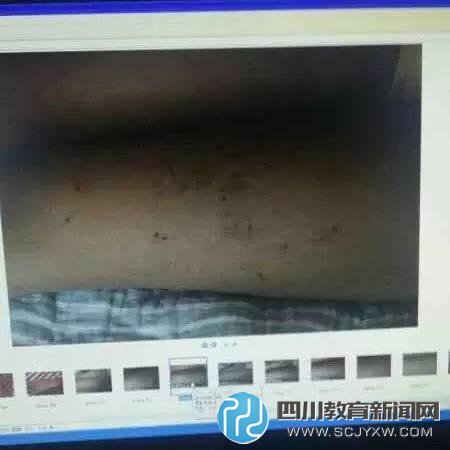女生被班长用笔戳伤70余处 因其成绩差拖后腿
