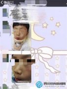 幼儿园老师让男孩互殴发泄精力 有人颈椎